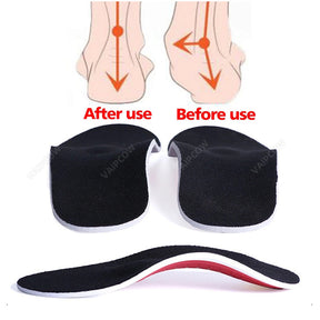 Bronoir™ Ortho Arch Clouds - Gratis indlægssåler